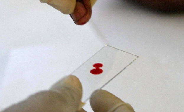 Учени откриха връзка между кръвните групи и рака