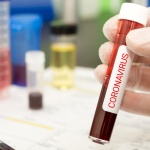 САЩ и Китай в люта схватка: Откъде тръгна коронавирусът?  