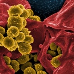 Растения - убийци на бактерии