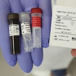 Стадният имунитет няма да ни спаси от COVID-19