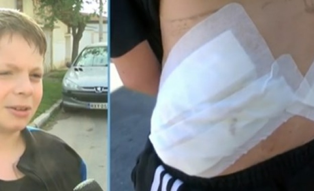 Детето нахапано от куче в Крън получило паник атаки То