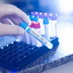 Новозаразените с Ковид-19 в Русия трети пореден ден са под 8000 