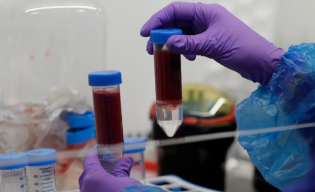 Кръвна проба взета по време на инфекция с КОВИД 19 може