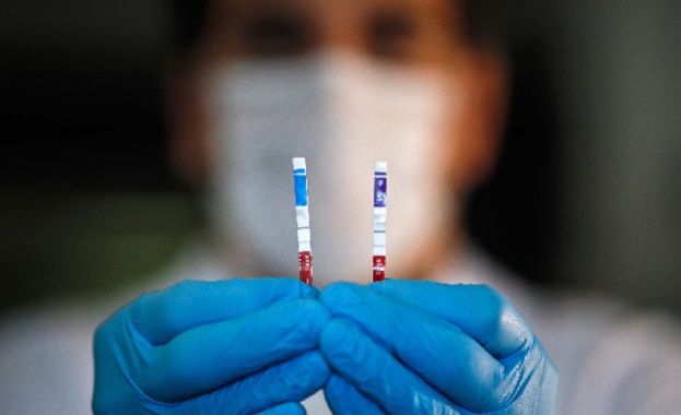 116 нови случая на COVID-19 при направени 3667 PCR теста 