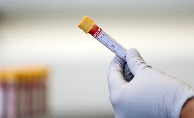 174 нови случаи на Covid-19 при направени 4835 PCR теста 