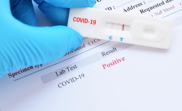 1 589 са новите случаи на COVID-19