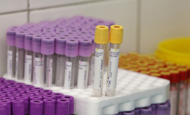 Френски изследователи са разработили нов тест за коронавирус който според