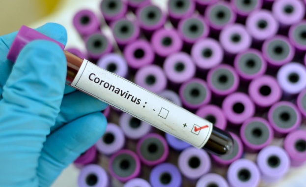Новите случаи на оронавирус у нас са 346. Това показват