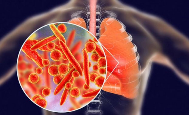 Ръст на случаите на пневмонии след грип в болниците в Смолянско