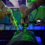 Робот извърши първата лапароскопска операция без лекар