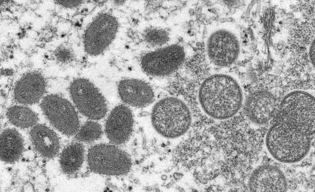 НЦЗПБ съобщава за потвърден четвърти случай на маймунска вариола Заболелият