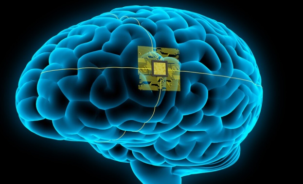 Oчакват се клинични тестове върху хора на безжичен мозъчен чип