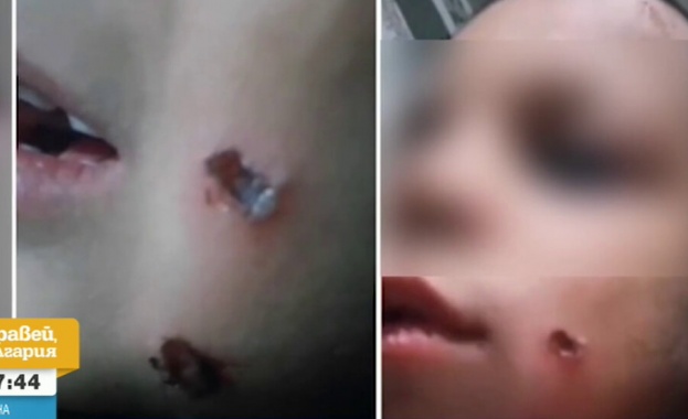 Прокуратурата и социалните в Кърджали разследват случай на малтретирано дете