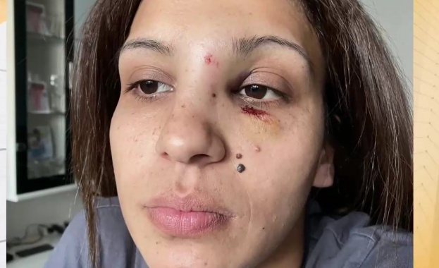 Жена твърди, че е пребита от бившия си съпруг пред малкото им дете