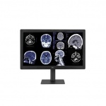 Новият LGмонитор за диагностика с IPS BLACK осигурява изпитано качество на изображението