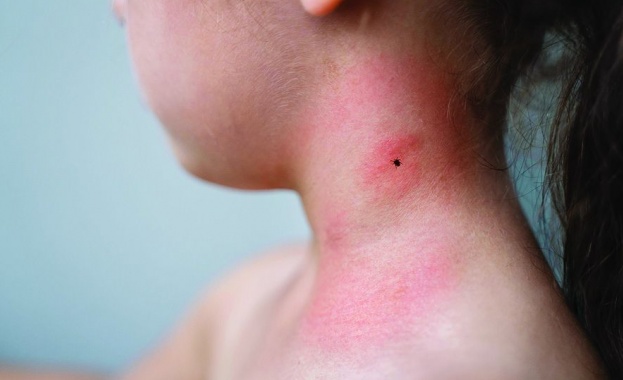 Според статистиката кърлежите хапят деца по често от възрастни а домашните