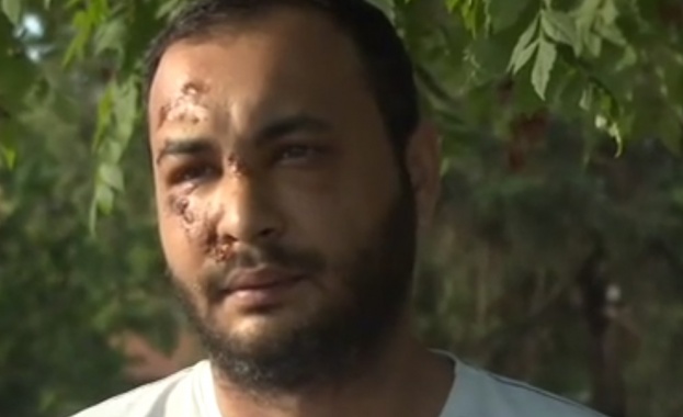 30-годишен мъж от Силистра се оплака от полицейско насилие. Ерсун