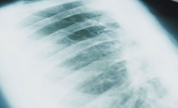 При диагнозата „муковисцидоза“ ранното изследване е решаващо