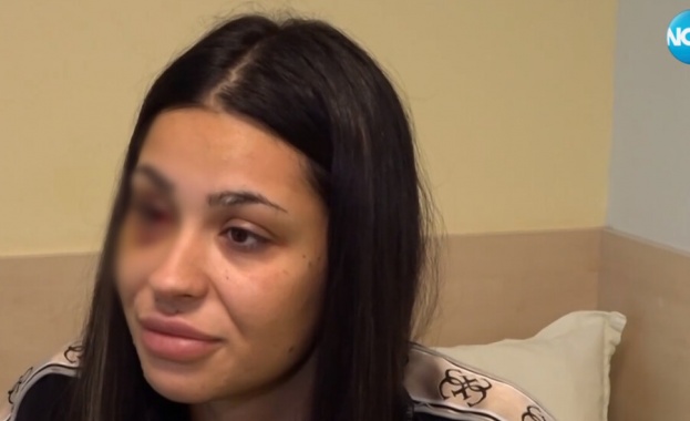 Пребитата жена в Бургас: Имам гной и кръв в белия дроб