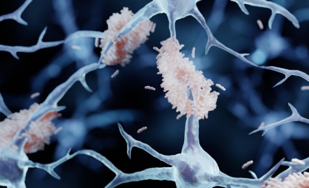 Учени откриха протеин против стареене, който блокира рак и Алцхаймер