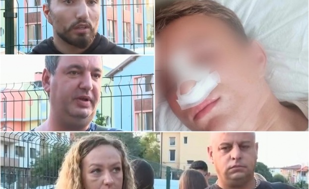 Жесток побой над трима тийнейджъри на 15 години в Айтос