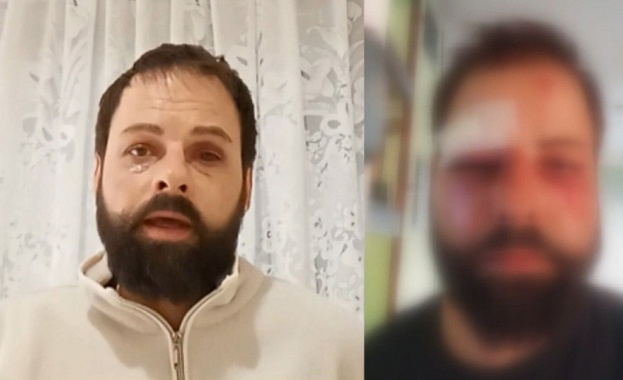 Мъж твърди че е пребит на работното си място от