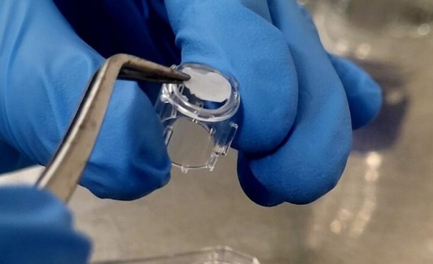 Български учени създадоха прототип на човешка кожа за проучвания в