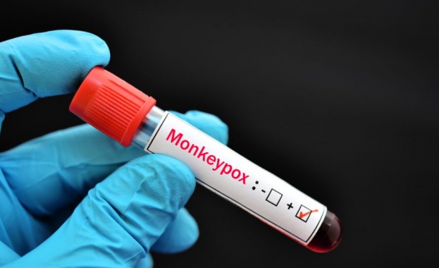 Трети случай на маймунска шарка у нас