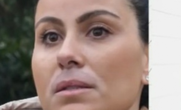 Жена твърди че е обезобразена след дерматологична процедура с лазер