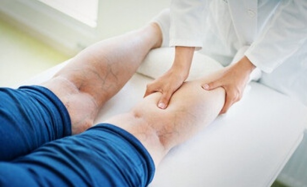 Методи за неоперативно лечение на вени и капиляри