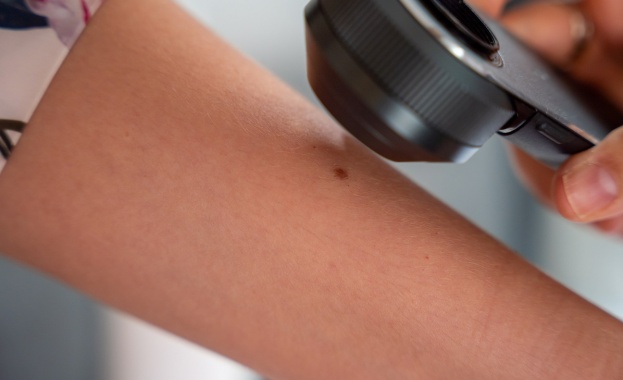 Стартира кампанията SaveYourSkin с безплатни профилактични прегледи на бенки
Водещата дермокозметична