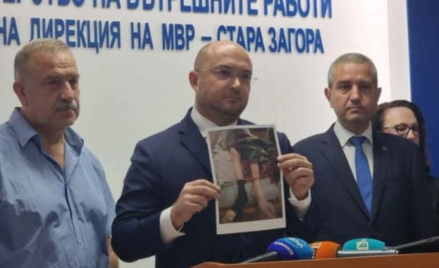 Възрастни хора с психически заболявания в тежко състояние са държани