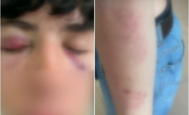 Пореден случай на насилие между деца този път сигналът е