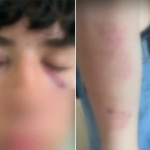 Пореден случай на насилие между деца, този път сигналът е от Русе
