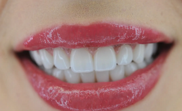 Д-р Яна Бялева: Софтуер показва как ще изглежда финално усмивката ви след лечение с алайнери