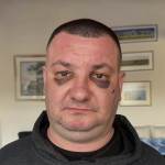 Завързан с белезници и ритан в главата: Мъж твърди, че е жестоко пребит в дискотека в Троян