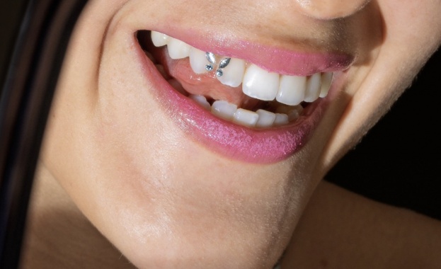 Интервю с д р Ибрахим Бялев за зъбните бижута като