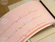 Лягането по едно и също време може да предпази здравето на сърцето, сочи проучване