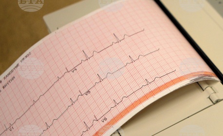 Лягането по едно и също време може да предпази здравето на сърцето, сочи проучване
